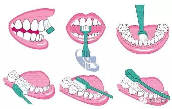 中华口腔医学会发布--标准刷牙方法【完整版】
